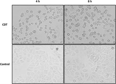 The Binary Toxin of Clostridioides difficile Alters the Proteome and Phosphoproteome of HEp-2 Cells